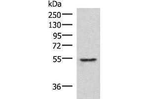 Western blot analysis of Jurkat cell lysate using TUBD1 Polyclonal Antibody at dilution of 1:1000 (TUBD1 anticorps)