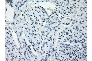Immunohistochemical staining of paraffin-embedded Kidney tissue using anti-AURKCmouse monoclonal antibody. (Aurora Kinase C anticorps)