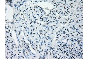 Immunohistochemical staining of paraffin-embedded Kidney tissue using anti-AURKCmouse monoclonal antibody.