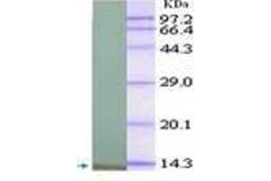 Image no. 1 for anti-Chemokine (C-X-C Motif) Ligand 1 (Melanoma Growth Stimulating Activity, Alpha) (CXCL1) (AA 36-107) antibody (ABIN791562)