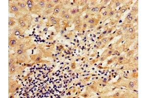 IHC image of ABIN7148621 diluted at 1:800 and staining in paraffin-embedded human liver tissue performed on a Leica BondTM system.