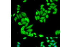 Immunofluorescence analysis of HeLa cells using IKK beta Polyclonal Antibody (IKBKB anticorps)