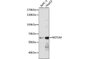 Western blot analysis of extracts of various cell lines, using NOTUM antibody (ABIN7268961) at 1:1000 dilution.