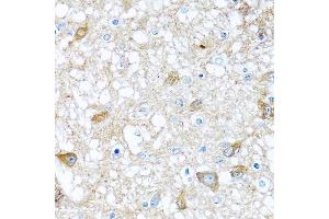 Immunohistochemistry of paraffin-embedded rat brain using BMP5 antibody.