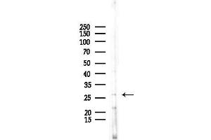 Western blot analysis of lysates from COLO205 cells, using PSM Antibody at 1/1000 dilution.