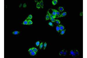 Immunofluorescent analysis of HepG2 cells using ABIN7150506 at dilution of 1:100 and Alexa Fluor 488-congugated AffiniPure Goat Anti-Rabbit IgG(H+L)