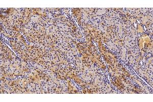 Detection of TF in Porcine Kidney Tissue using Polyclonal Antibody to Transferrin (TF) (Transferrin anticorps)