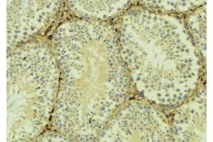 ABIN6275992 at 1/100 staining Mouse testis tissue by IHC-P. (FZD6 anticorps  (C-Term))