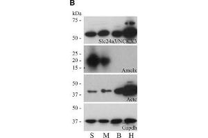 Western blot analyses of PMCA1-4, and NCKX3 in secretory-stage and maturation-stage rat enamel organs.