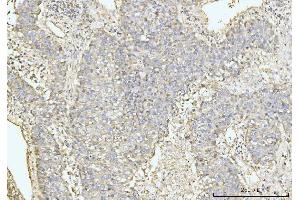 IHC analysis of GRPEL1 using anti-GRPEL1 antibody (ABIN7602643). (GRPEL1 anticorps  (AA 90-217))