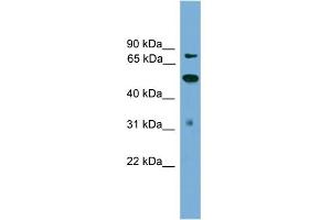 WB Suggested Anti-TLK2 Antibody Titration: 0. (TLK2 anticorps  (N-Term))