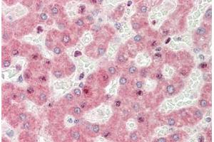 Human Liver: Formalin-Fixed, Paraffin-Embedded (FFPE)