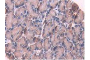 IHC-P analysis of Rat Pancreas Tissue, with DAB staining. (CYP1A1 anticorps  (AA 251-521))