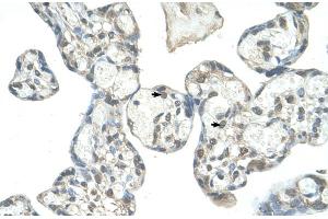 Human Placenta (EPS8-Like 1 anticorps  (N-Term))