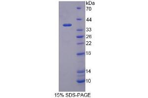 SDS-PAGE analysis of Human TIF1b Protein. (KAP1 Protéine)