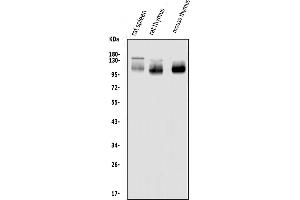 Western blot analysis of SELPLG using anti-SELPLG antibody (ABIN7600337). (SELPLG anticorps  (AA 18-397))