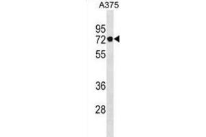 Western Blotting (WB) image for anti-Podocan (PODN) antibody (ABIN3001059) (Podocan anticorps)