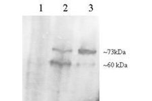Image no. 1 for anti-Proprotein Convertase Subtilisin/kexin Type 9 (PCSK9) (C-Term) antibody (ABIN374535)
