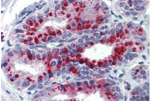 anti-Potassium Channel, Subfamily K, Member 9 (KCNK9) (AA 36-85) antibody