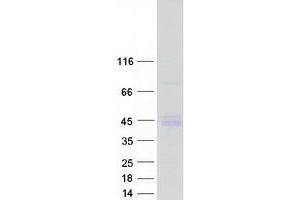 Validation with Western Blot
