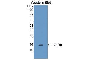 Western blot analysis of the recombinant protein. (SLIT3 anticorps  (AA 1449-1523))