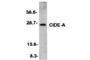 Western Blotting (WB) image for anti-Cell Death-Inducing DFFA-Like Effector A (CIDEA) (C-Term) antibody (ABIN1030334) (CIDEA anticorps  (C-Term))