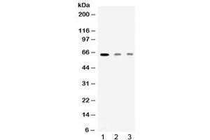Western blot testing of 1) rat skeletal muscle, 2) human HeLa and 3) human MCF7 lysate with AMHR2 antibody at 0. (AMHR2 anticorps)