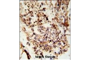 Formalin-fixed and paraffin-embedded human testis tissue reacted with ACR Antibody (C-term), which was peroxidase-conjugated to the secondary antibody, followed by DAB staining.