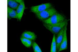 Immunofluorescence analysis of HeLa cells using PRKCA antibody (ABIN4904772). (PKC alpha anticorps)