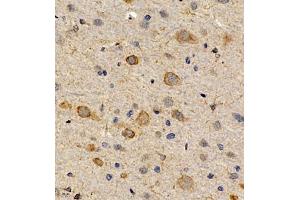 Immunohistochemistry of paraffin embedded rat brain using CCRL2 (ABIN7073461) at dilution of 1:300 (400x lens) (CCRL2 anticorps)
