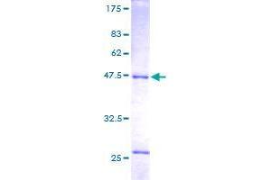 Image no. 1 for RAB14, Member RAS Oncogene Family (RAB14) (AA 1-215) protein (GST tag) (ABIN1317039)