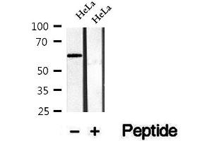 Western blot analysis of extracts of HeLa cells, using Phospho-CTDSPL2 (Ser104) Antibody.
