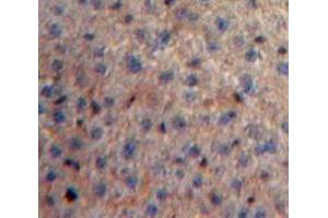 Used in DAB staining on fromalin fixed paraffin-embedded Liver tissue