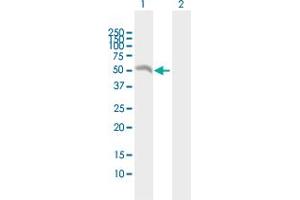 Western Blot analysis of EIF2B3 expression in transfected 293T cell line by EIF2B3 MaxPab polyclonal antibody.