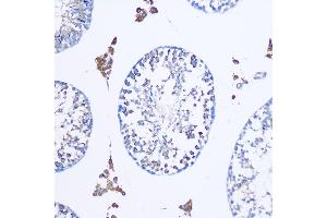 Immunohistochemistry of paraffin-embedded Mouse testis using TGN46/TGN46/TGOLN2 Rabbit pAb (ABIN7270876) at dilution of 1:100 (20x lens). (TGOLN2 anticorps)