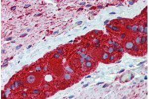 anti-Tubulin, beta 2A (TUBB2A) (AA 1-446) antibody