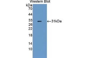 Western blot analysis of the recombinant protein. (Complement Factor I anticorps  (AA 358-603))