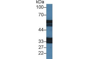 Western blot analysis of Mouse Stomach lysate, using Mouse IL18R1 Antibody (2 µg/ml) and HRP-conjugated Goat Anti-Rabbit antibody ( (IL18R1 anticorps  (AA 182-336))