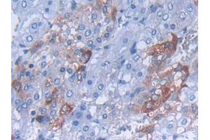 IHC-P analysis of Rat Adrenal gland Tissue, with DAB staining. (CARTPT anticorps  (AA 28-129))