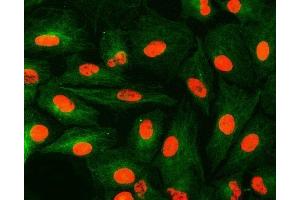 IF analysis of U1A/SNRPA and Tubulin beta using anti-U1A/SNRPA antibody (ABIN7600891) and anti-Tubulin beta antibody (ABIN7602744). (SNRPA1 anticorps  (AA 25-218))