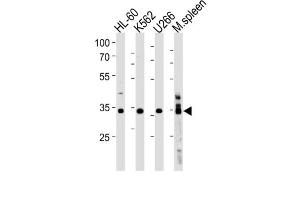 Western Blotting (WB) image for anti-Growth Factor Independent 1B Transcription Repressor (GFI1B) antibody (ABIN3004598) (GFI1B anticorps)