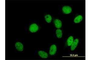 Immunofluorescence of purified MaxPab antibody to GTF3C2 on HeLa cell. (GTF3C2 anticorps  (AA 1-911))