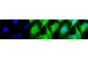 Immunocytochemistry/Immunofluorescence analysis using Rabbit Anti-HO-1 Polyclonal Antibody (ABIN361673 and ABIN361674).