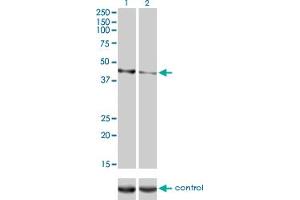 Western blot analysis of CALR3 over-expressed 293 cell line, cotransfected with CALR3 Validated Chimera RNAi (Lane 2) or non-transfected control (Lane 1). (Calreticulin 3 anticorps  (AA 21-384))