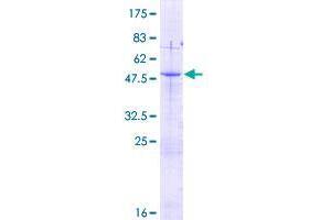Image no. 1 for A Kinase (PRKA) Interacting Protein 1 (AKIP1) (AA 1-210) protein (GST tag) (ABIN1347054)