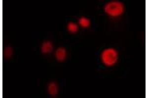 anti-Forkhead Box B1/2 (FOXB1/2) antibody