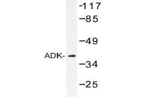 Western blot (WB) analysis of ADK antibody in extracts from RAW264. (ADK anticorps)