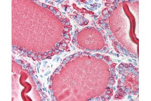 Anti-TG / Thyroglobulin antibody IHC of human thyroid. (Thyroglobulin anticorps)