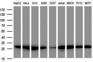 Image no. 4 for anti-Proteasome Subunit alpha 2 (PSMA2) (AA 50-234) antibody (ABIN1491566) (PSMA2 anticorps  (AA 50-234))
