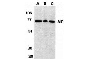 Western Blotting (WB) image for anti-Apoptosis-Inducing Factor, Mitochondrion-Associated, 1 (AIFM1) (Middle Region) antibody (ABIN1030846) (AIF anticorps  (Middle Region))